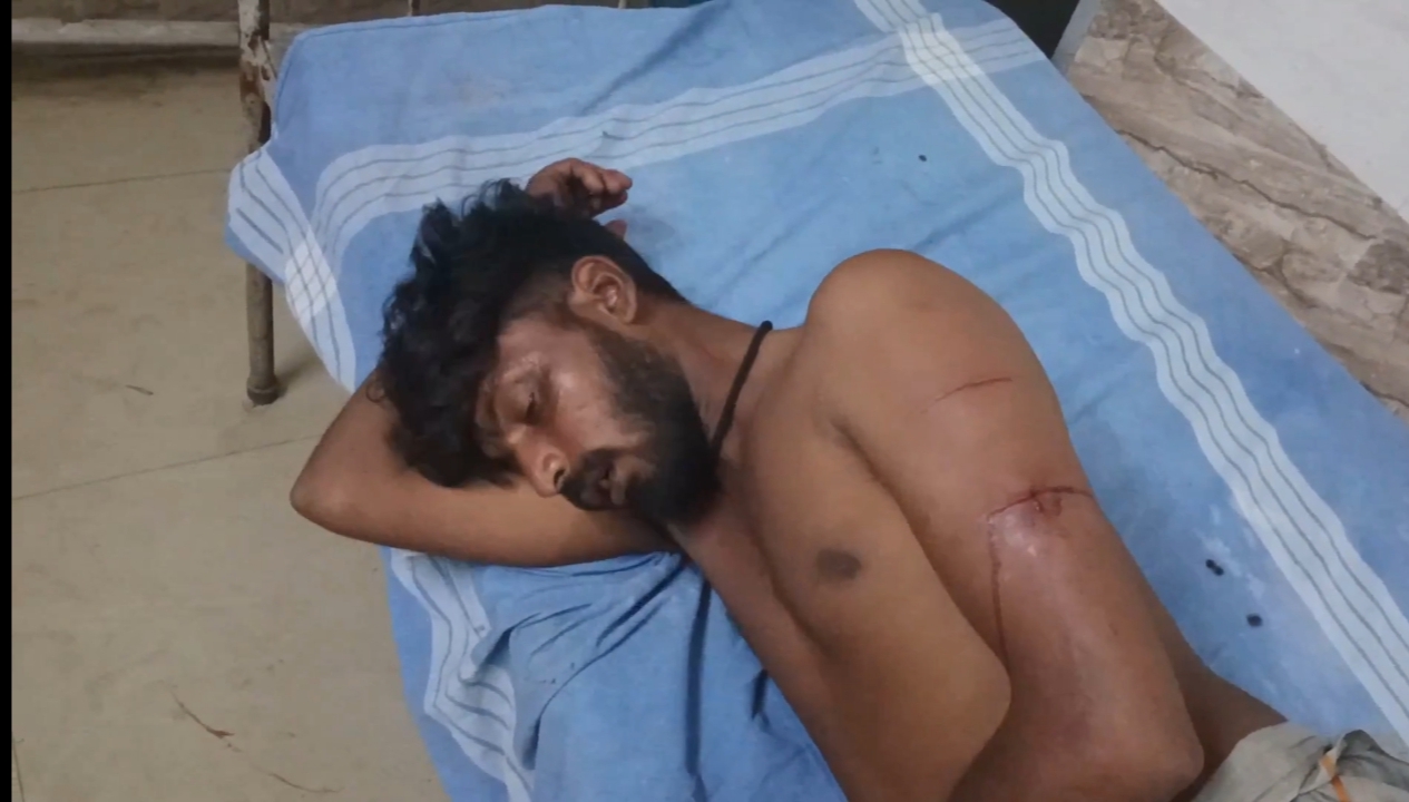 உசிலம்பட்டி அரசு மருத்துவமனை வளாகத்தில் – மது போதையில் ஏற்பட்ட தகராறில் இளைஞரை, ஆட்டோ ஓட்டுநர் அறிவாளால் வெட்டிய சம்பவம் பரபரப்பை ஏற்படுத்தியுள்ளது.,