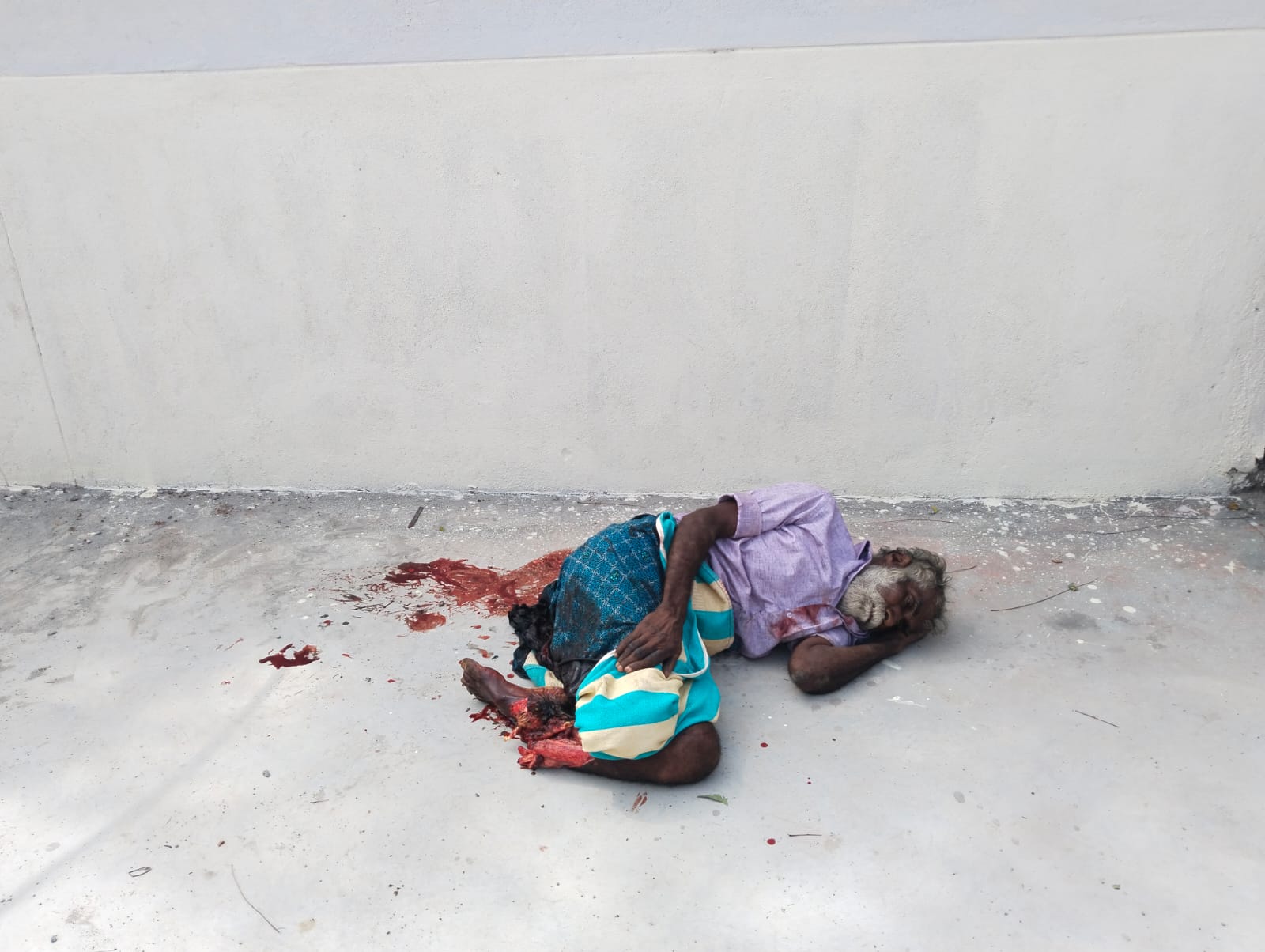 சோழவந்தான் ரயில் நிலையம் அருகே ரயிலில் இருந்து தவறி விழுந்தவரின் கால் முறிந்தது மற்றொரு கால் சேதம்